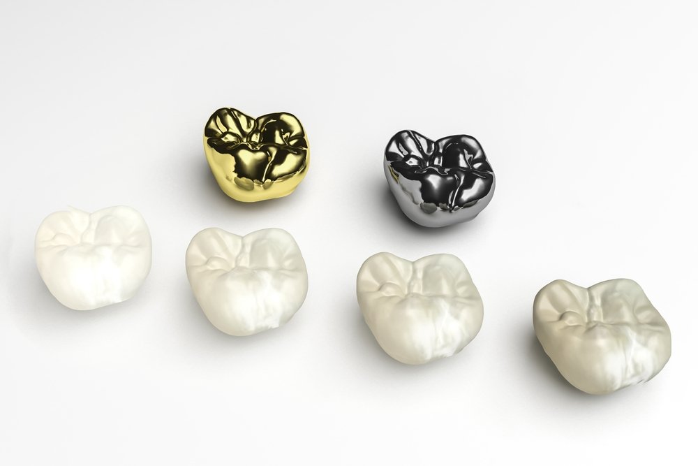 Răng thuần sứ có tính thẩm mỹ và độ bền cao hơn răng sứ hợp kim