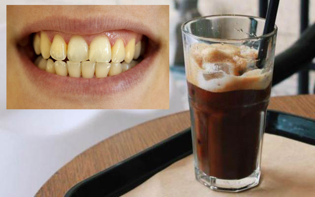Hạn chế các thực phẩm và đồ uống có màu để không gây ố vàng răng