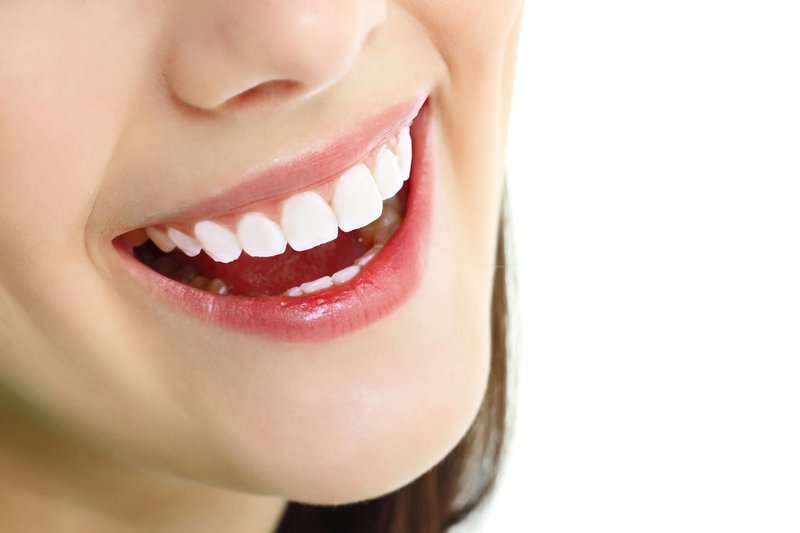 Vì sao nên chọn răng sứ có nguồn gốc rõ ràng?