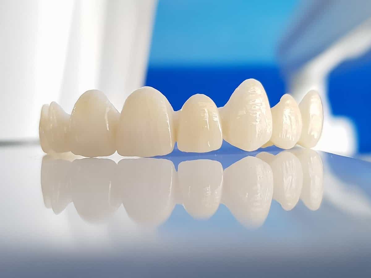 Trên thị trường hiện có rất nhiều loại răng sứ, trong đó răng toàn sứ là chất liệu có tuổi thọ cao nhất