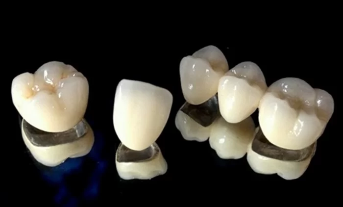 Răng sứ Titan mang đến thẩm mỹ cho người sử dụng