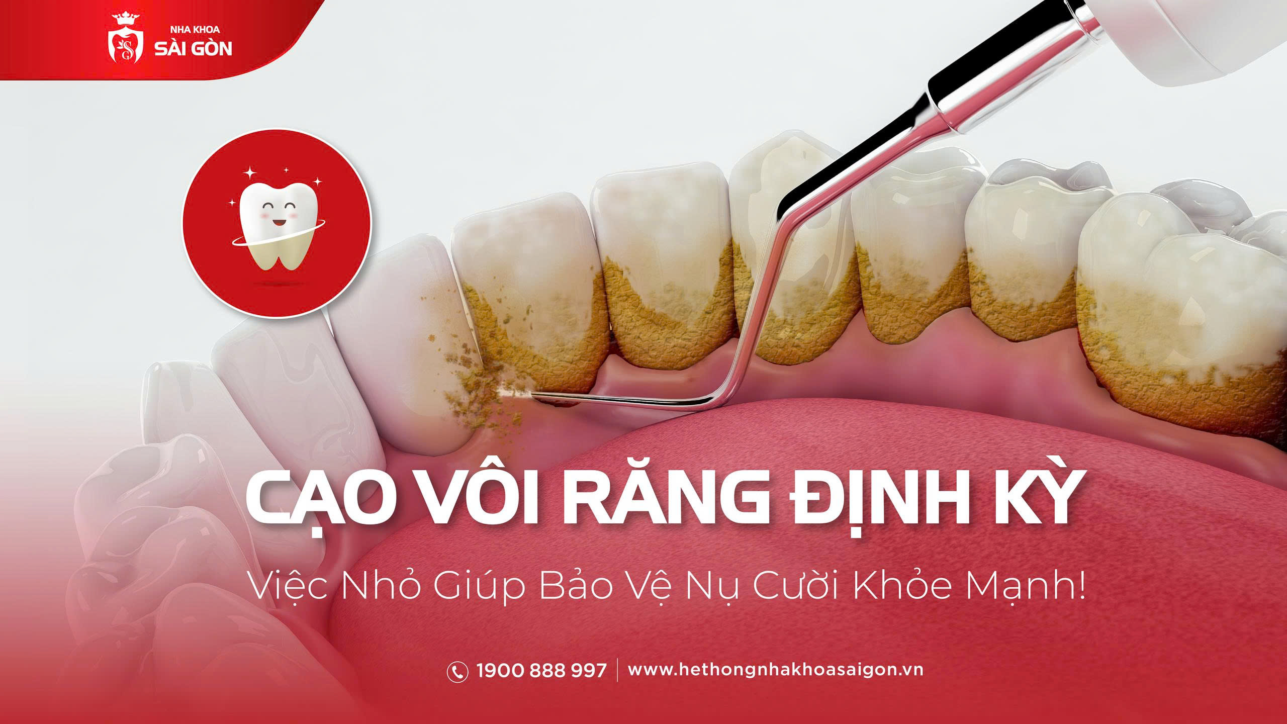 Cạo vôi răng định kỳ tại Nha Khoa Sài Gòn