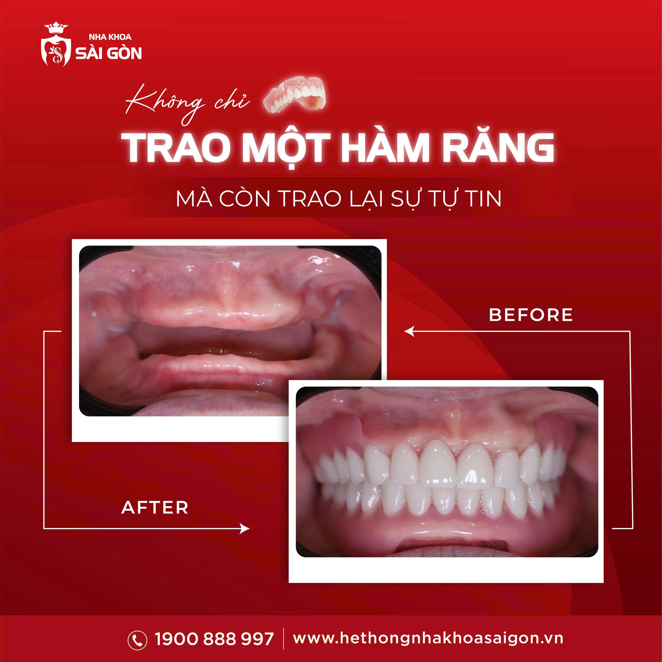 hoàn thiện nụ cười giúp các hoàn cảnh khó khăn ăn nhai tốt cải thiện sức khỏe