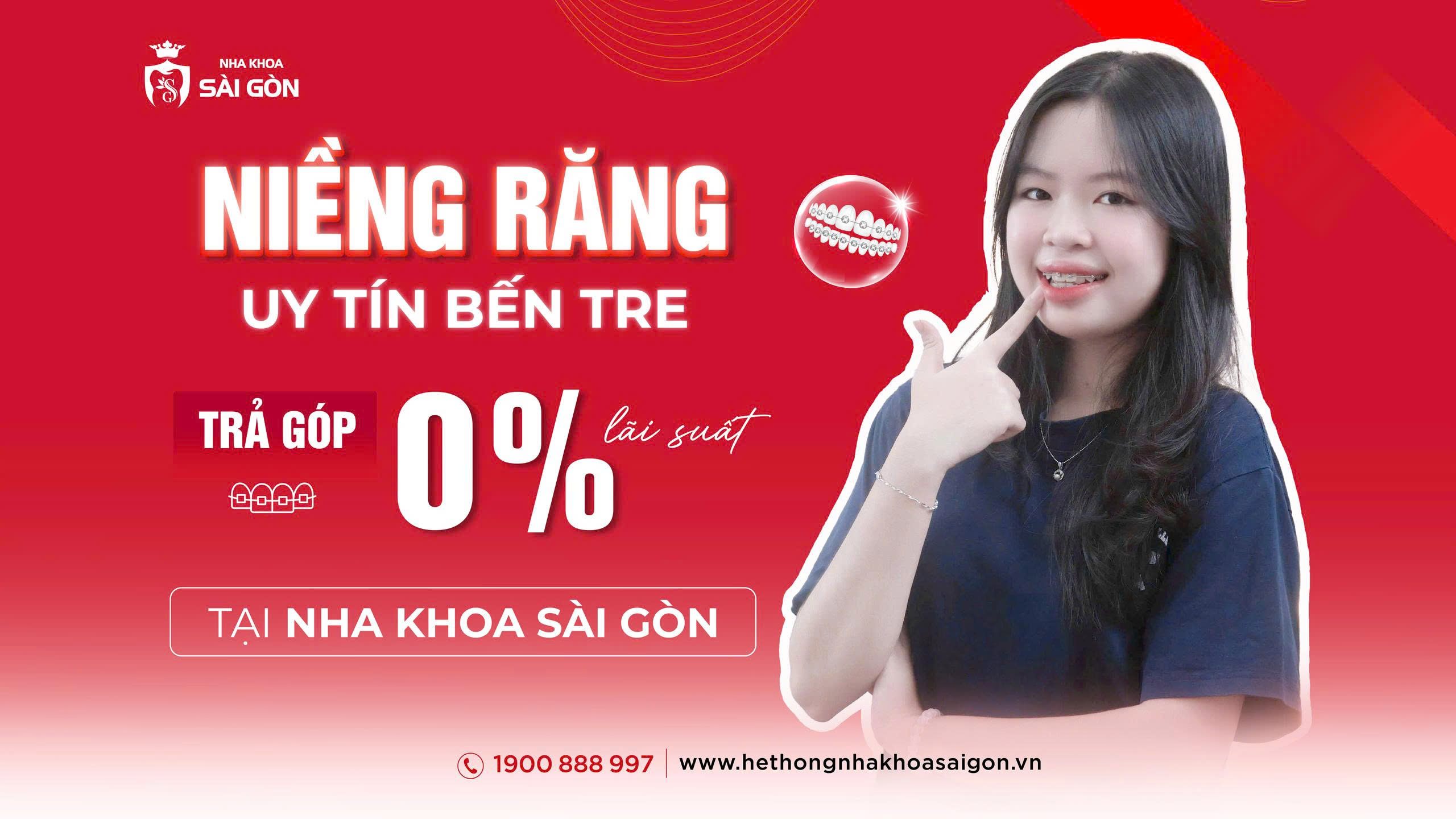 niềng răng uy tín bến tre trả góp 0% lãi suất