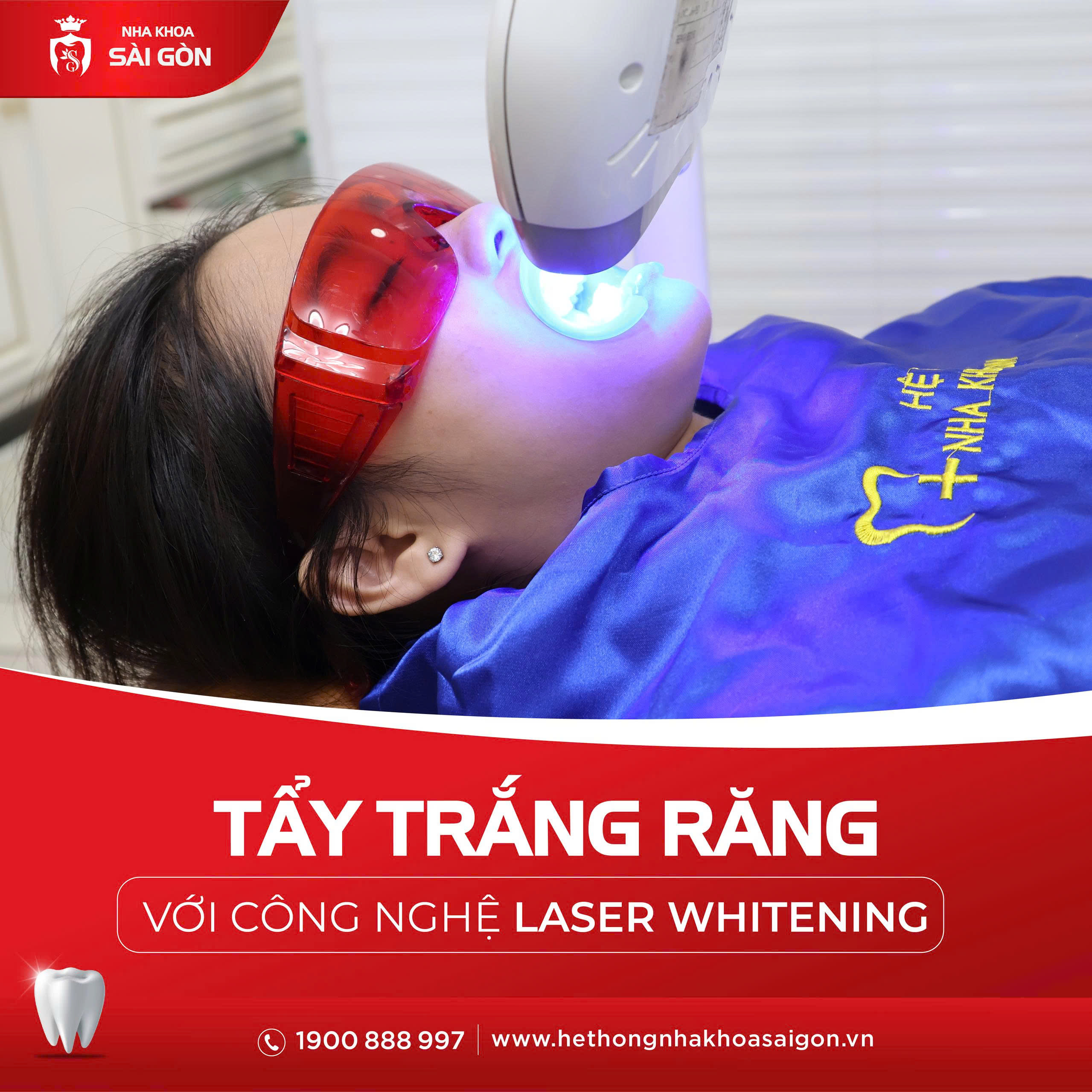 tẩy trắng răng nhiễm tetracycline