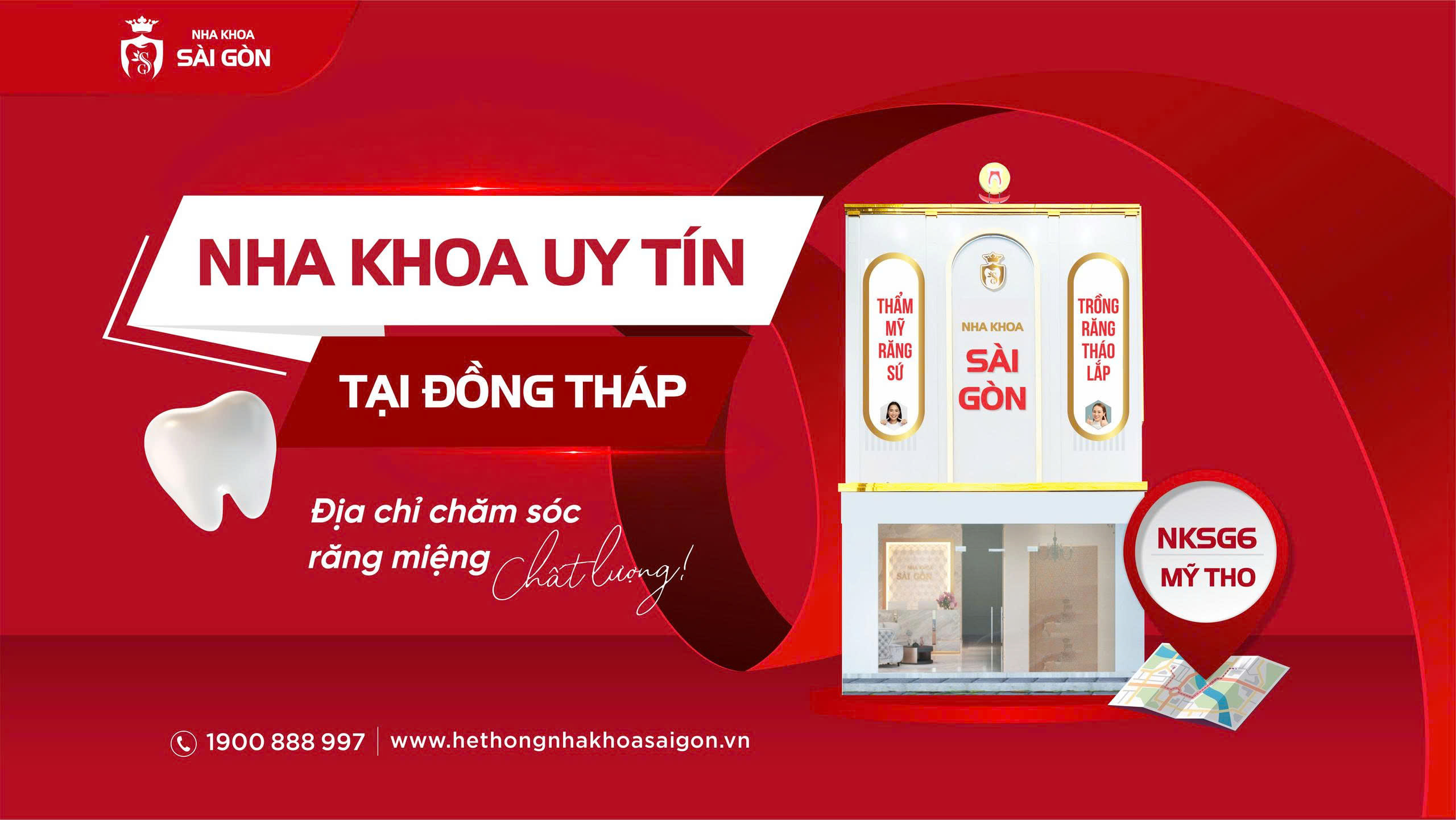 Nha Khoa Sài Gòn – địa chỉ chăm sóc răng miệng uy tín tại Đồng Tháp.
