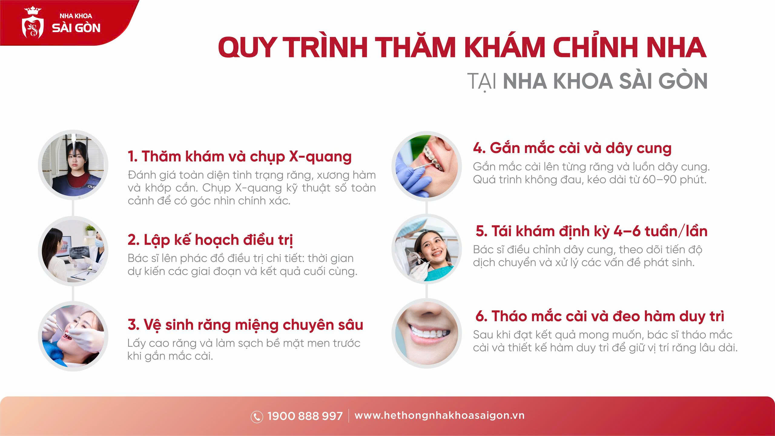 quy trình niềng răng tại nha khoa sài gòn