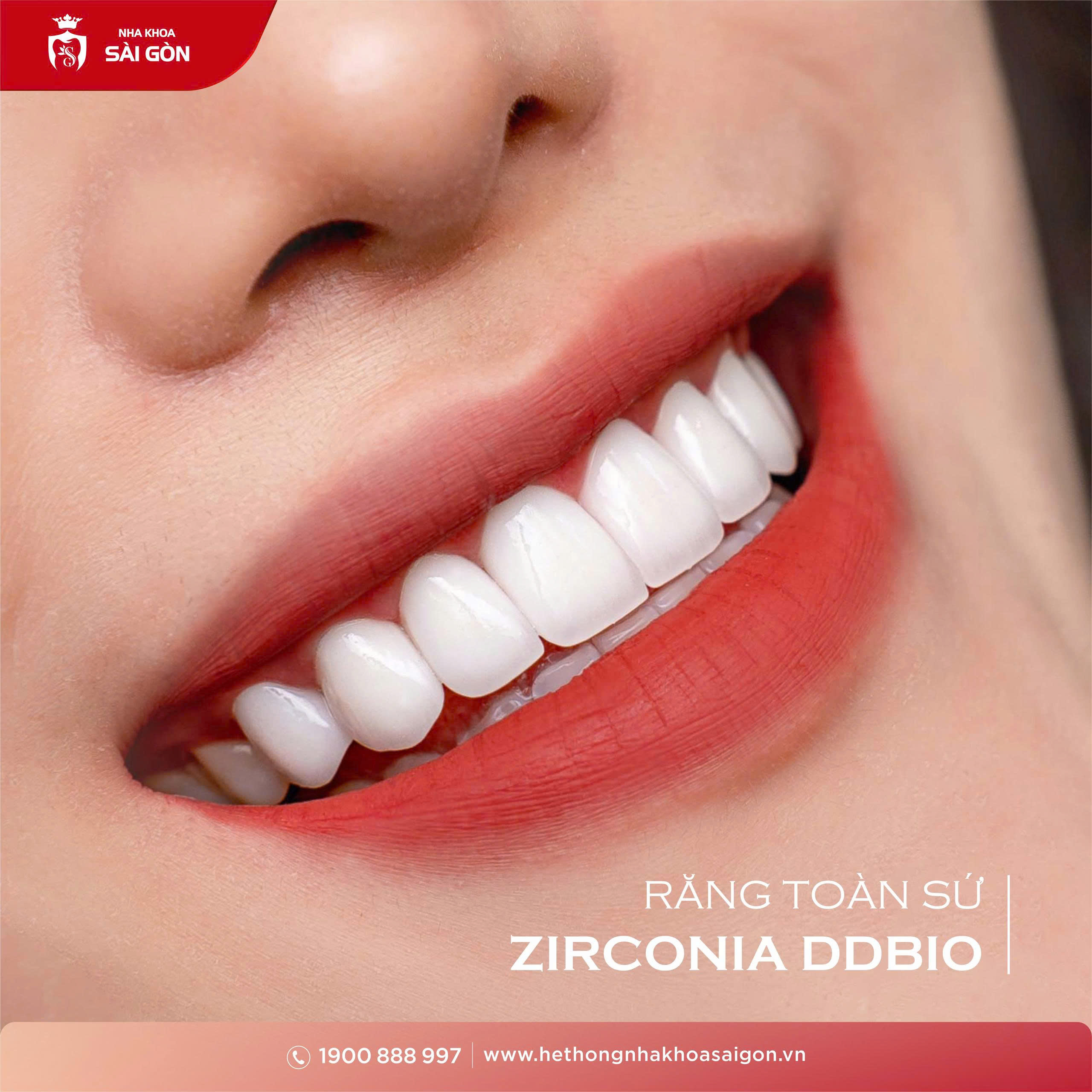 Răng sứ Zirconia DDBio có màu sắc trong, thẩm mỹ tự nhiên